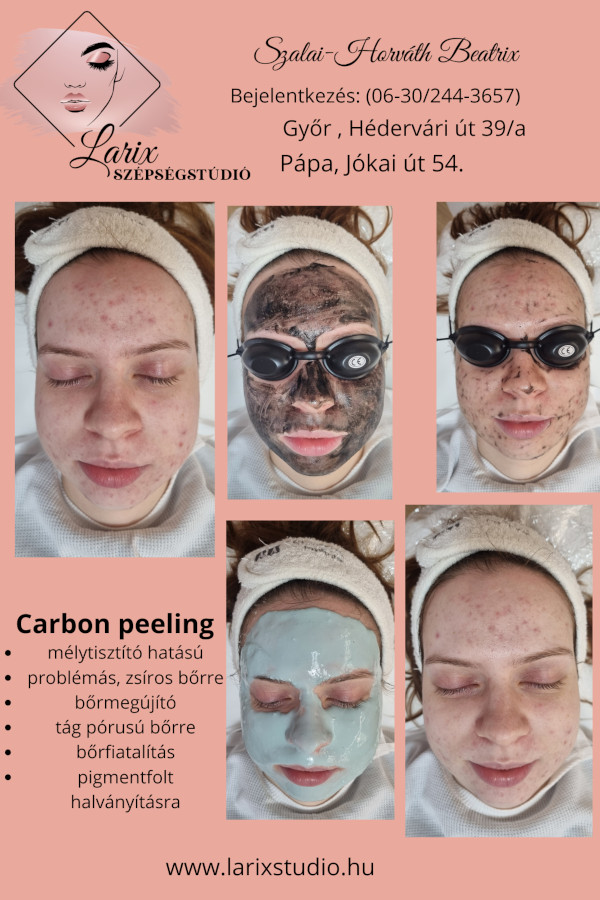Larix Szépségstúdió Pápa Carbon Peeling